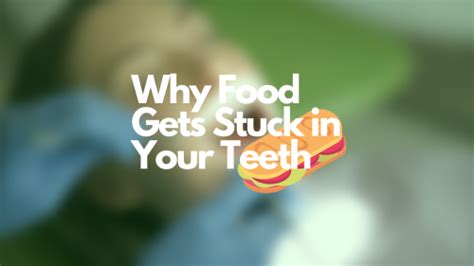 The Food Advice Reasons Why Food Gets Stuck In Your Teeth