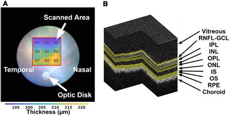 Longitudinal Normative Oct Retinal Thickness Data For Wild Type Mice And Characterization Of