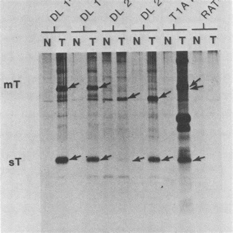 Autoradiograph Of A Sds Polyacrylamide Gel Showing The Location