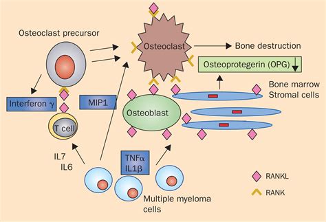 New Insights Into The Pathophysiology Of Multiple Myeloma The Lancet