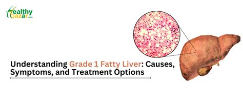 Understanding Grade 1 Fatty Liver Causes Symptoms And Treatment Options