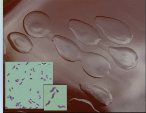 Bordetella And Campylobacter Spp Flashcards Quizlet