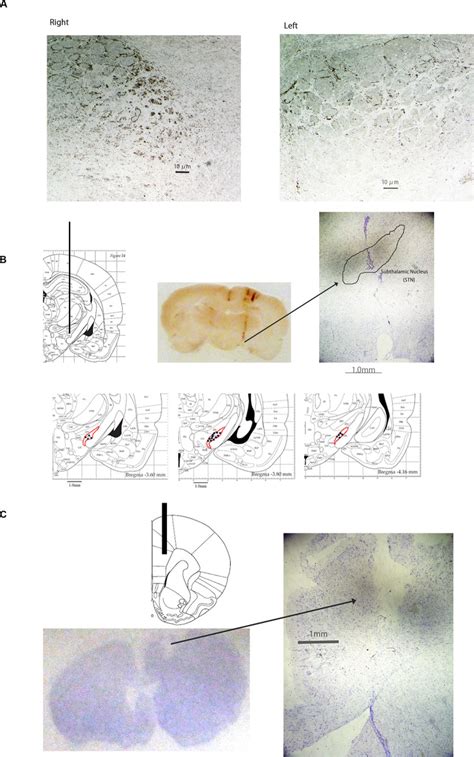 Subthalamic Stimulation Inhibits Bladder Contraction By Modulating The