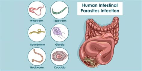 Stomach Worm Infections: Know Types And Symptoms For Differentiation ...