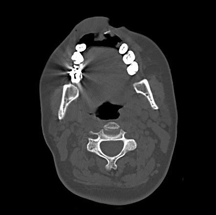 Image Radiopaedia Org