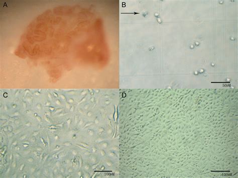 Matrigelinduced Tubular Morphogenesis Of Human Eccrine Sweat Gland