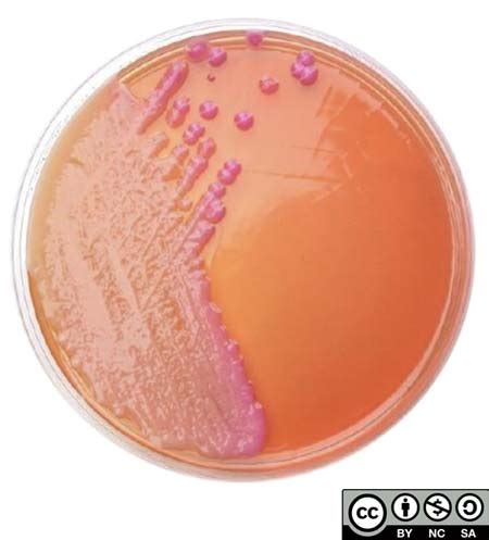 Macconkey Agar Klebsiella Pneumoniae