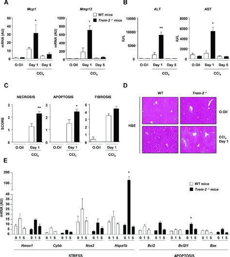 Trem 2 Impacts Chronic Ccl 4 Induced Liver Injury A E Wt And