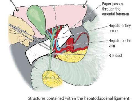 Irrigaci N Del Abdomen Ppt