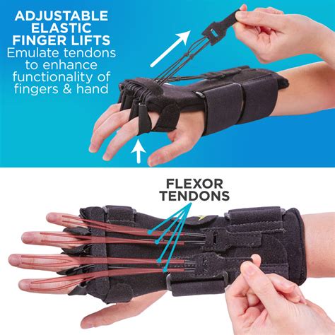 Radial Nerve Splint | Saturday Night Palsy Finger Extension Brace