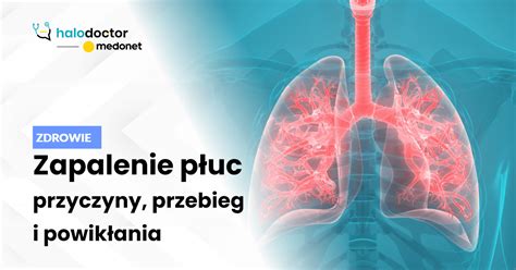 Pectolvan e Recepta Online z konsultacją lekarza opis leku