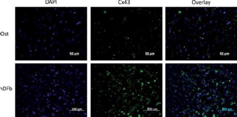 Fibroblasts Regulate Osteoblasts Through Gap Junctional Communication