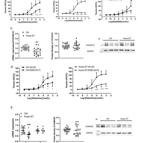 Functions Of L Type Voltage Dependent Calcium Channels And CAMK2 In