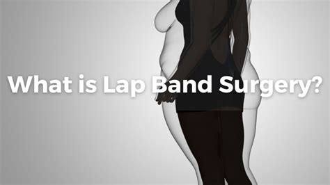 What Is Lap Band Surgery Hlb