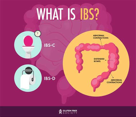 Is Your Ibs A Gluten Sensitivity Gluten Free Society