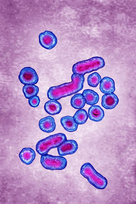 Hepatitis B Virus Stock Image C024 4694 Science Photo Library