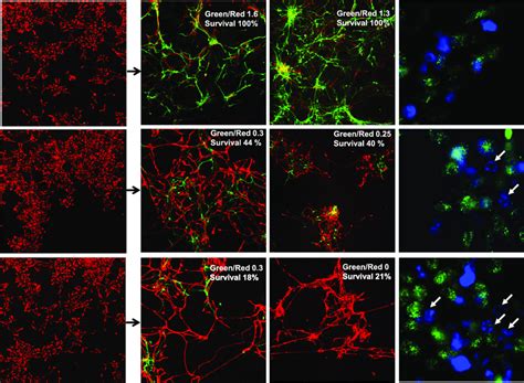 Neuronal Differentiation Of Human Nsc Neuronal Differentiation Was