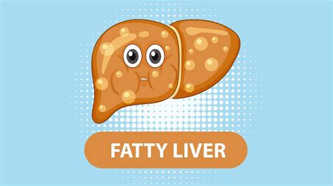 What Causes Fat Around the Liver? – NutritionFact.in