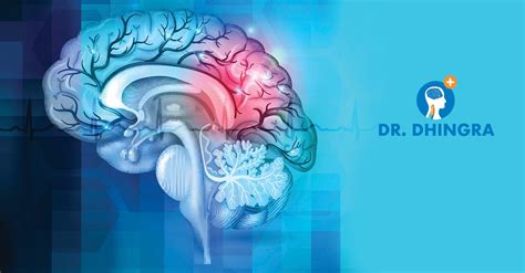 Pathophysiology Of Cerebrovascular Disease