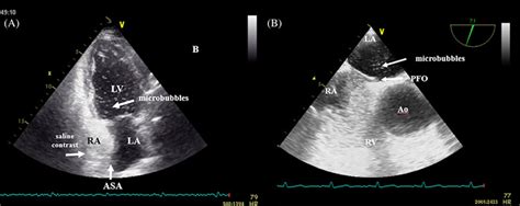 Multimodality Imaging Approach In Diagnosis And Therapy Of Various