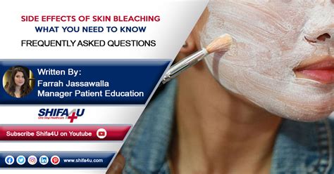 Side Effects of Skin Bleaching: What You Need To Know