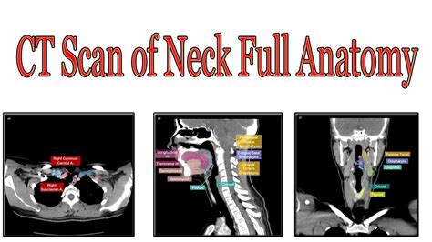 Ct Scan Neck Anatomy