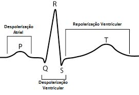 O Que Significa Alterações Da Repolarização Ventricular