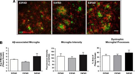 Human APOE4 increases microglia reactivity at Aβ plaques in a mouse