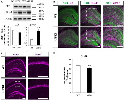 Frontiers Regional Contributions Of D Serine To Alzheimers Disease