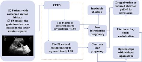 Diagnostic Accuracy And Cut Off Of Contrast Enhanced Ultrasound In