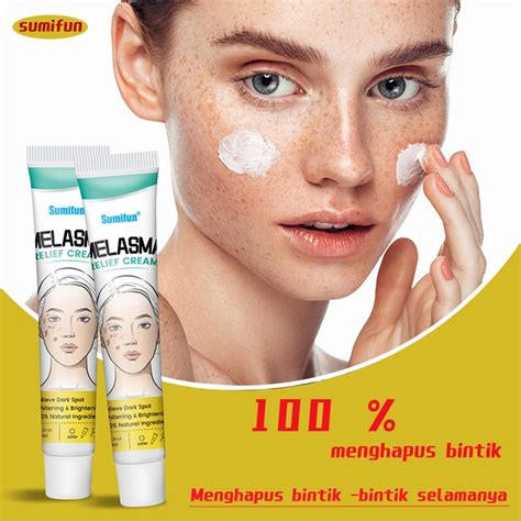 Jual Niacinamide Salep Flek Hitam Melasma Membandel Penghilang