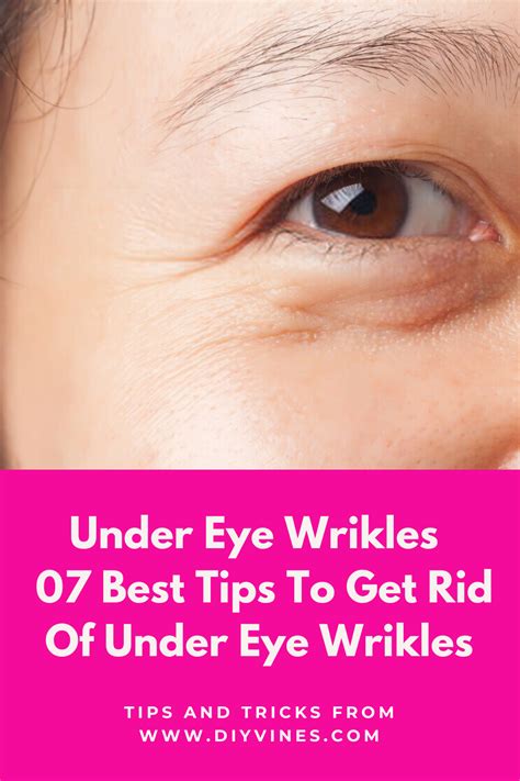 Under Eye Wrinkles - 07 Tips To Treat Under Eye Wrinkles | Under eye ...