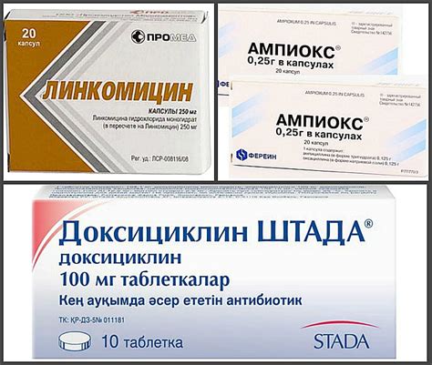 Лечение пародонтоза антибиотиками у взрослых