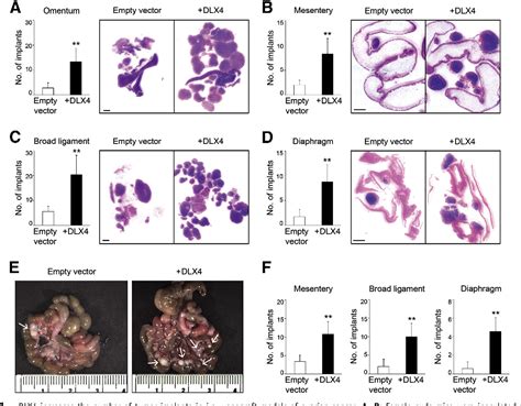 Table 1 From Tumorigenesis And Neoplastic Progression The Homeoprotein