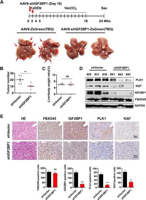 Elevated Fbxo45 Promotes Liver Tumorigenesis Through Enhancing Igf2bp1