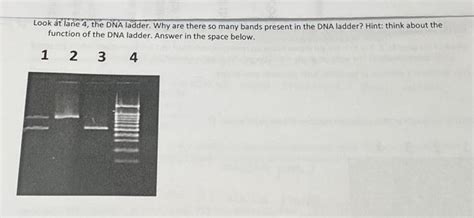 Solved Look at lane 4, the DNA ladder. Why are there so many | Chegg.com