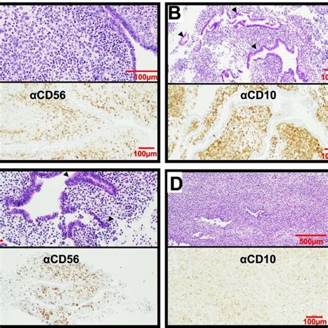 Me Contains Endometrial Tissues Histological Analysis Of Endometrial