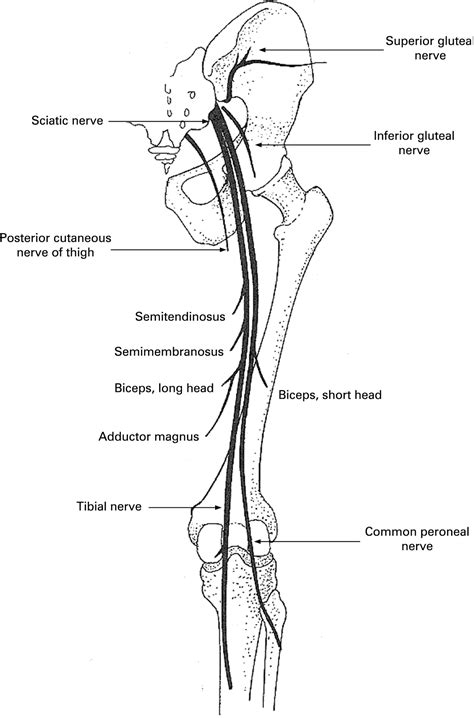 Foot Drop Where Why And What To Do Practical Neurology