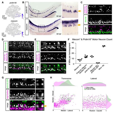 Prdm And Mecom Mark Dorsally Positioned Motor Neurons A Feature