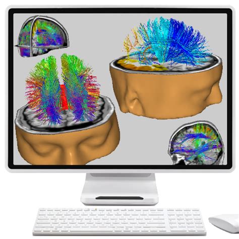 Neuronavigator Applied Neuroscience Inc