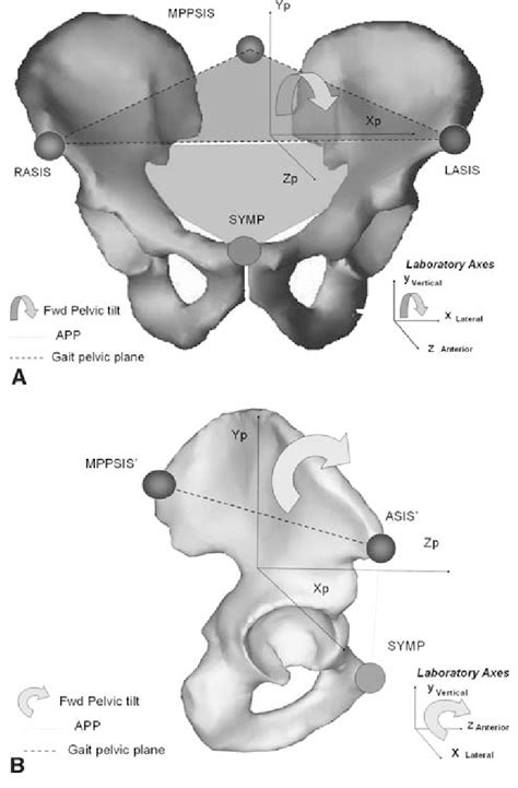 AB The A Anteroposterior Representation Of The Gait Pelvic Plane And