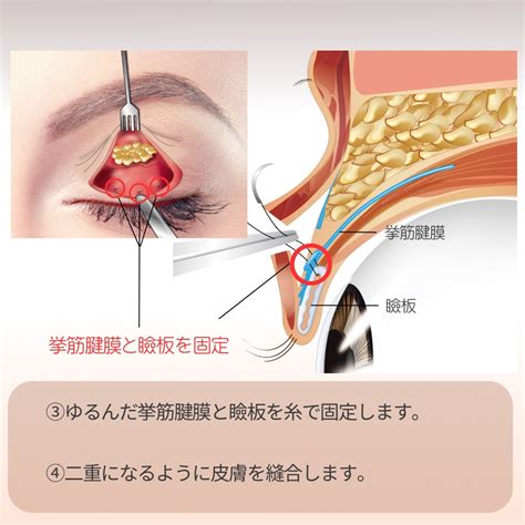 形成外科の疾患のメニュー｜金沢の皮膚科・形成外科はまぶたのクリニック