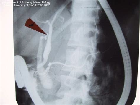 PRACTICAL ABDOMEN PELVIS Flashcards Quizlet