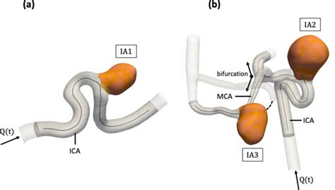 Near Wall Hemodynamic Parameters Quantification In In Vitro