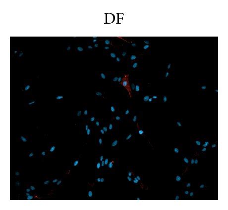 Cultured MSCs express smooth muscle cell markers. Expression of smooth ...