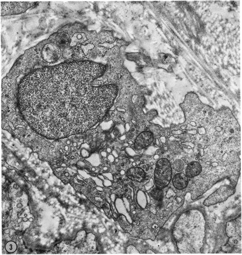 This Micrograph Shows A Monocyte In The Dermis Adjacent To A Day Old