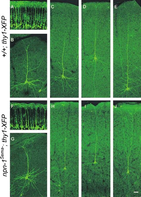 Figure From Neuropilin Conveys Semaphorin And Vegf Signaling During