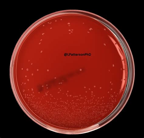 1 Male Patient Presents With Dysuria And Fever After Having