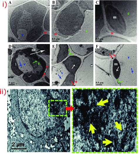 I Tem Analysis Of The Leaf Of The Rice Plant Under Different