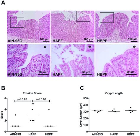 Morphology Of The Distal Colon Of Muc Mice Fed Ain G Hapf Or